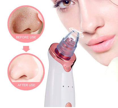 Electric Suction Blackhead Remover